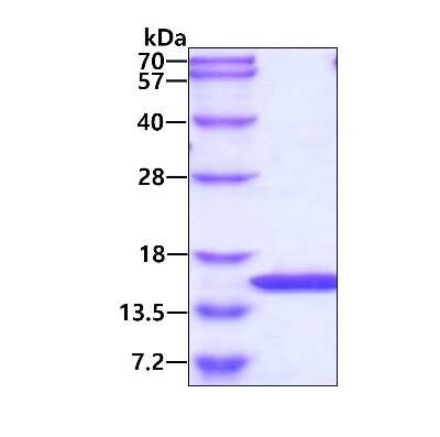 SDS-PAGE: Recombinant Human TBCA Protein [NBC1-28769]